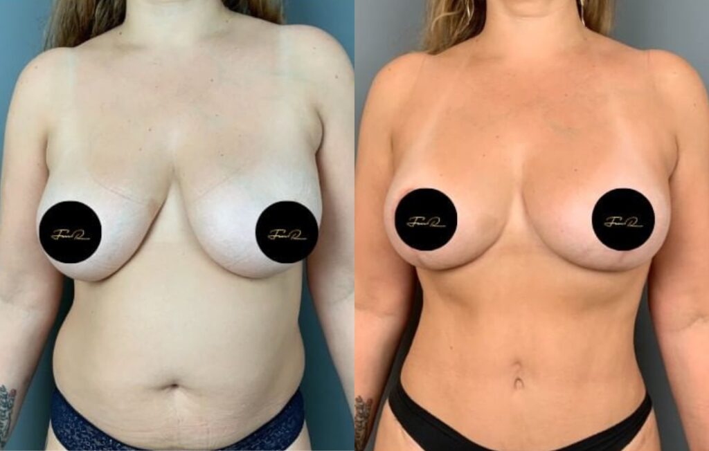 Caso Clínico My Body Back - Clínica FMR