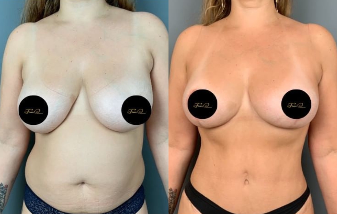 Caso Clínico My Body Back - Clínica FMR