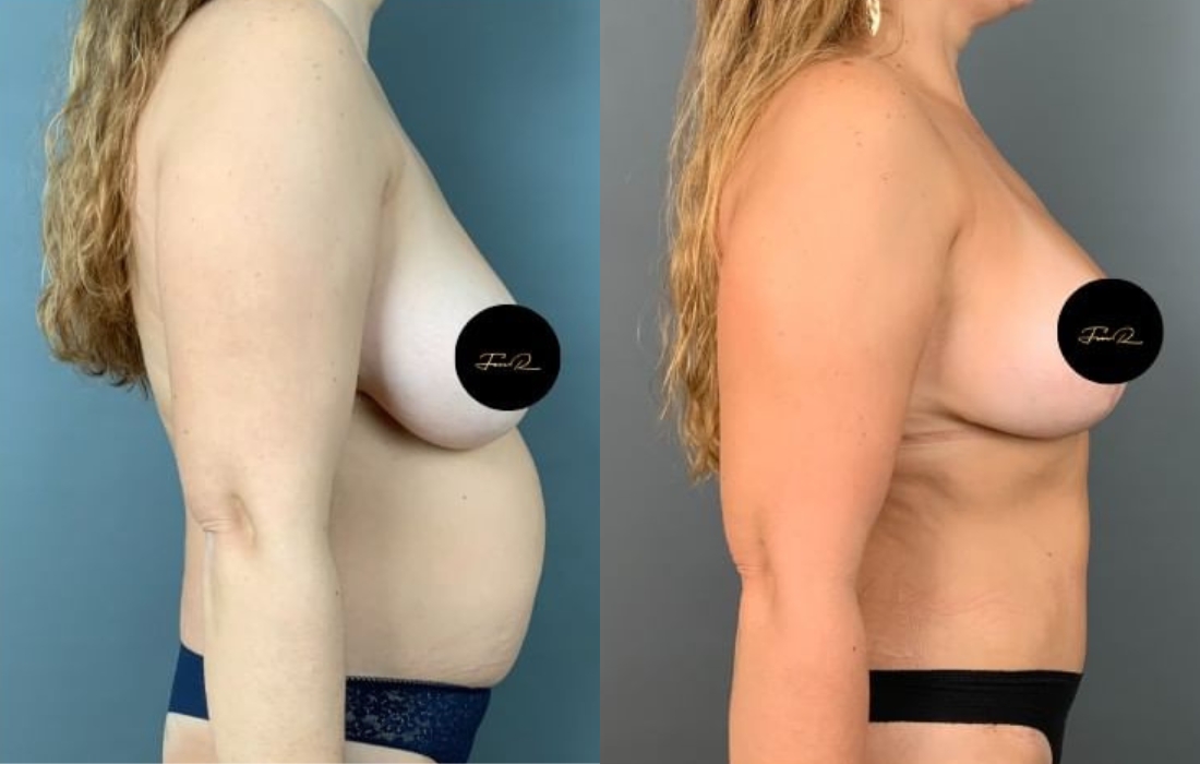 Caso Clínico My Body Back - Clínica FMR