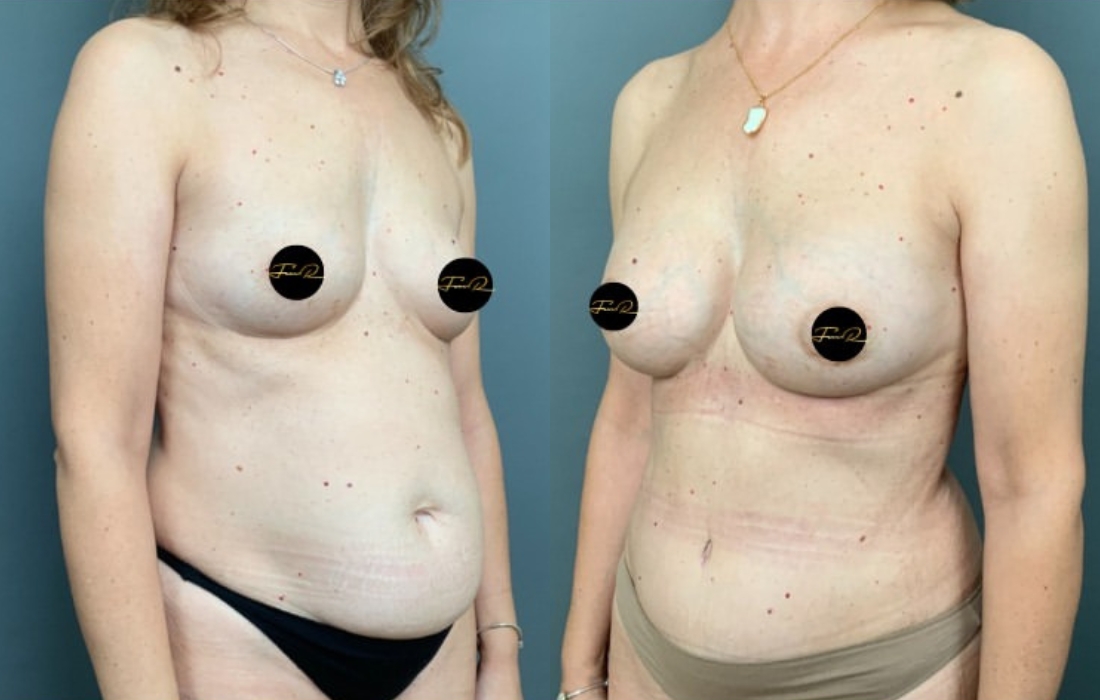 Caso Clínico My Body Back - Clínica FMR