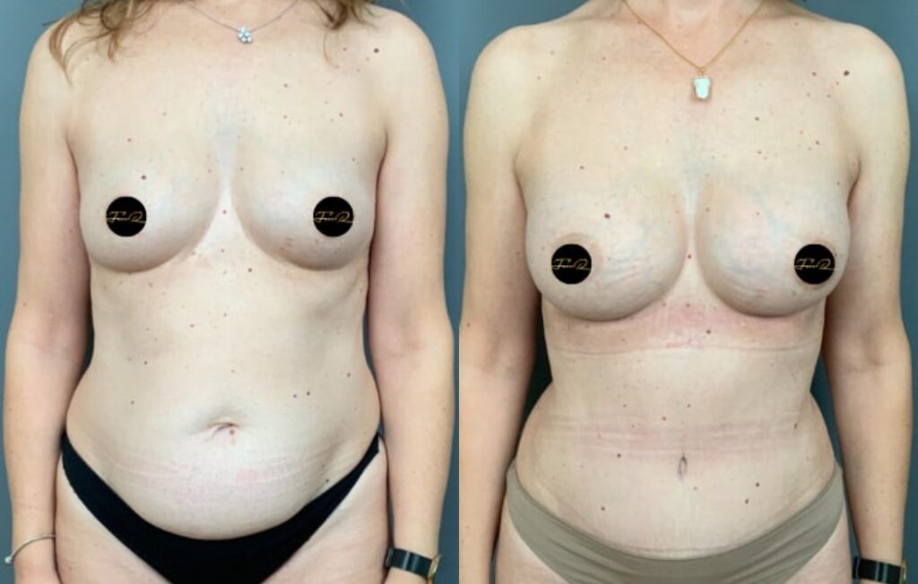 Caso Clínico My Body Back - Clínica FMR