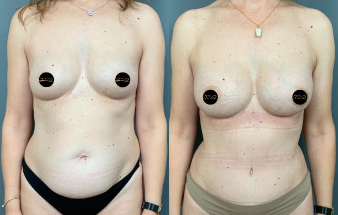 Caso Clínico My Body Back - Clínica FMR