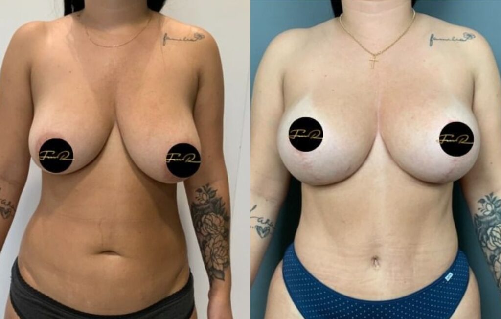 Caso Clínico My Body Back - Clínica FMR