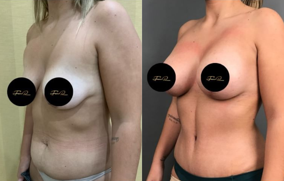 Caso Clínico My Body Back - Clínica FMR