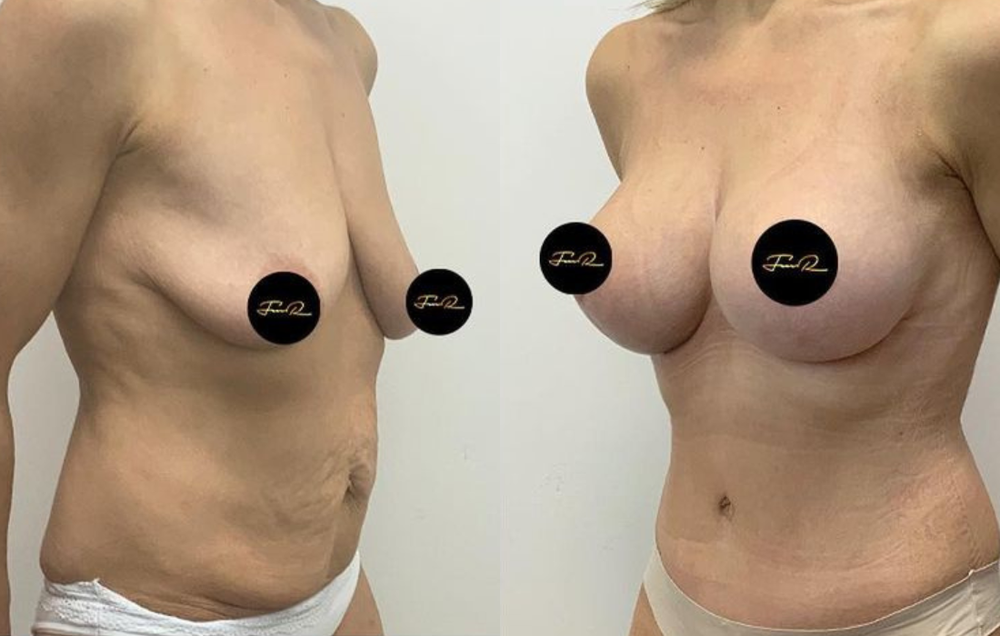Caso Clínico My Body Back - Clínica FMR