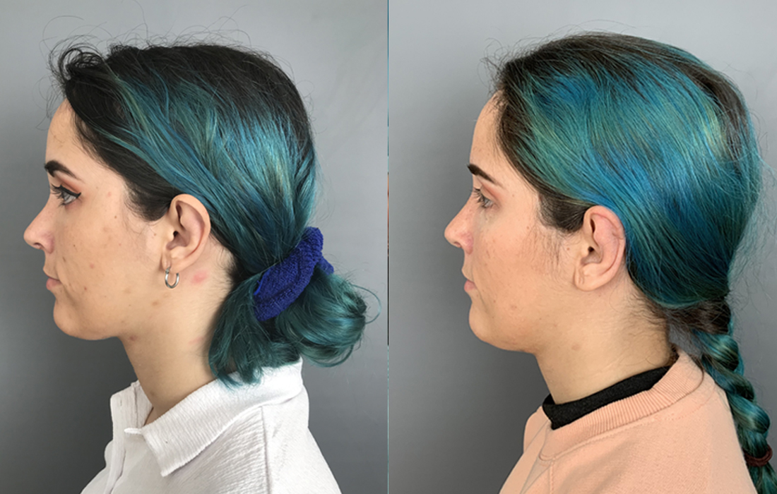 Otoplastia - Tratamentos Faciais Femininos - Clínica FMR