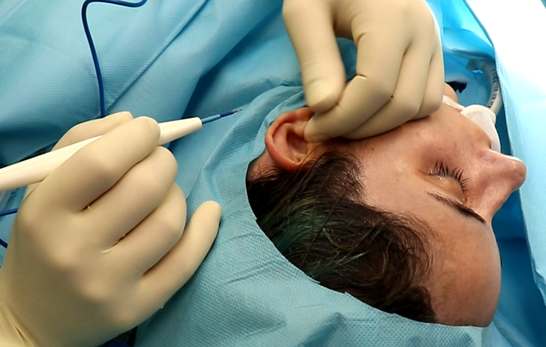 Otoplastia - Tratamentos Faciais Femininos - Clínica FMR
