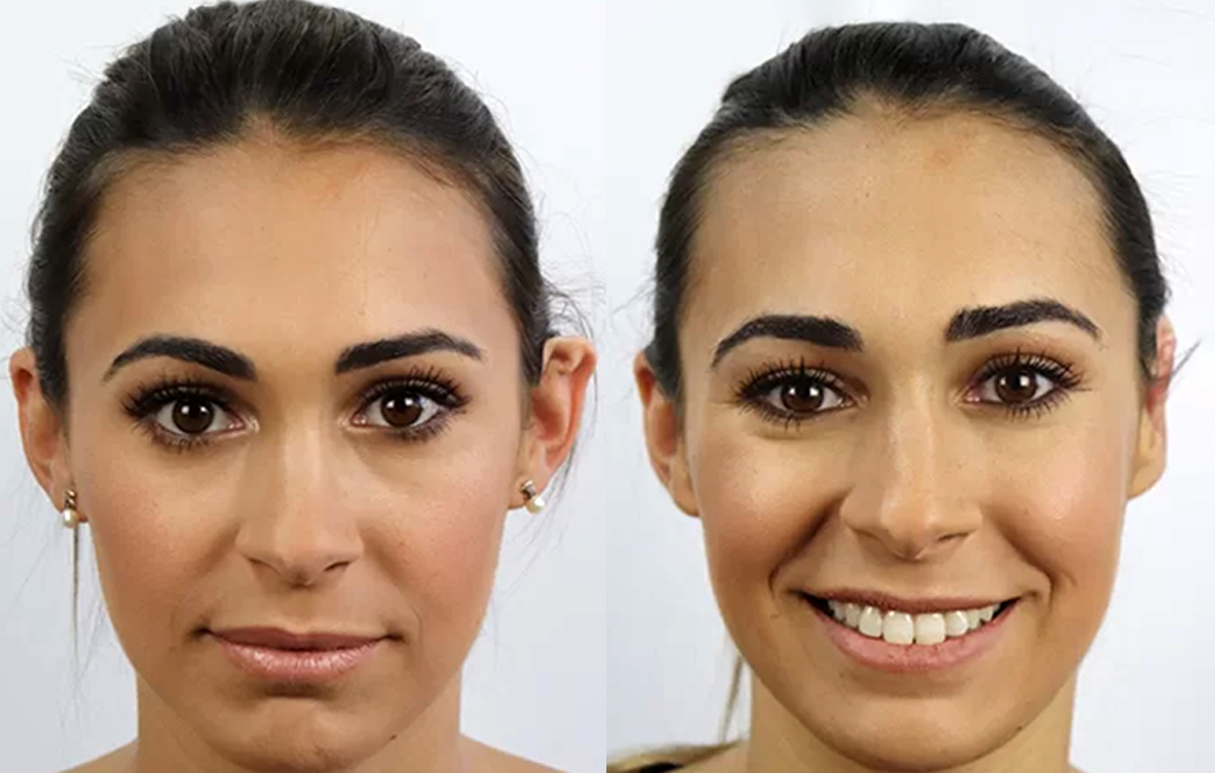 Otoplastia - Tratamentos Faciais Femininos - Clínica FMR
