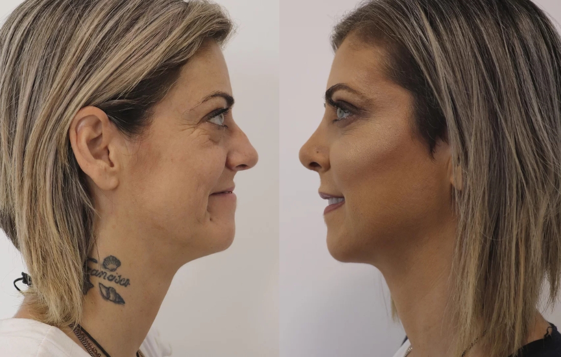Mudanças de Visual - Casa Feliz - Clínica FMR