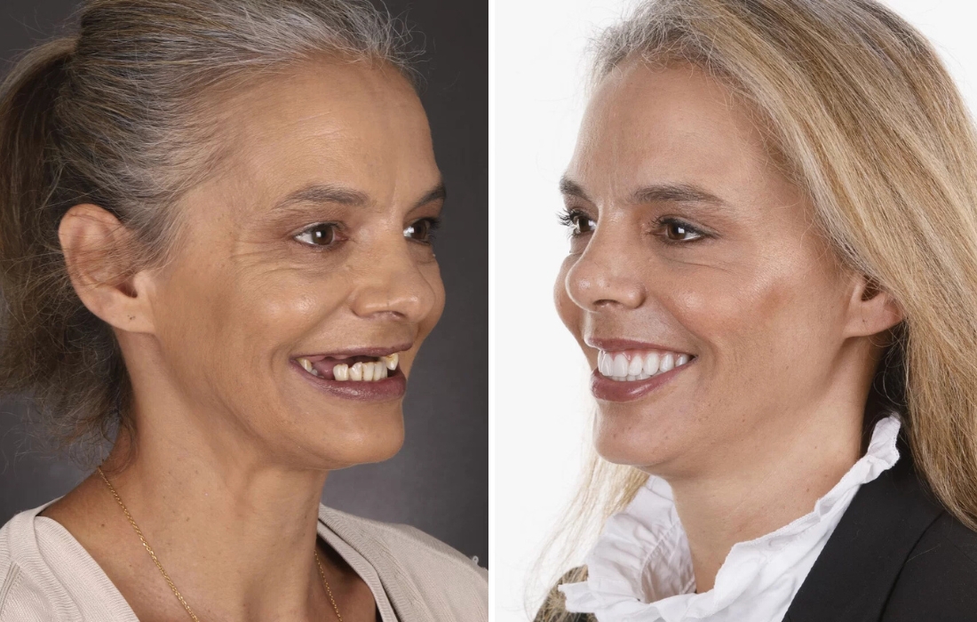 Mudanças de Visual - Casa Feliz - Clínica FMR