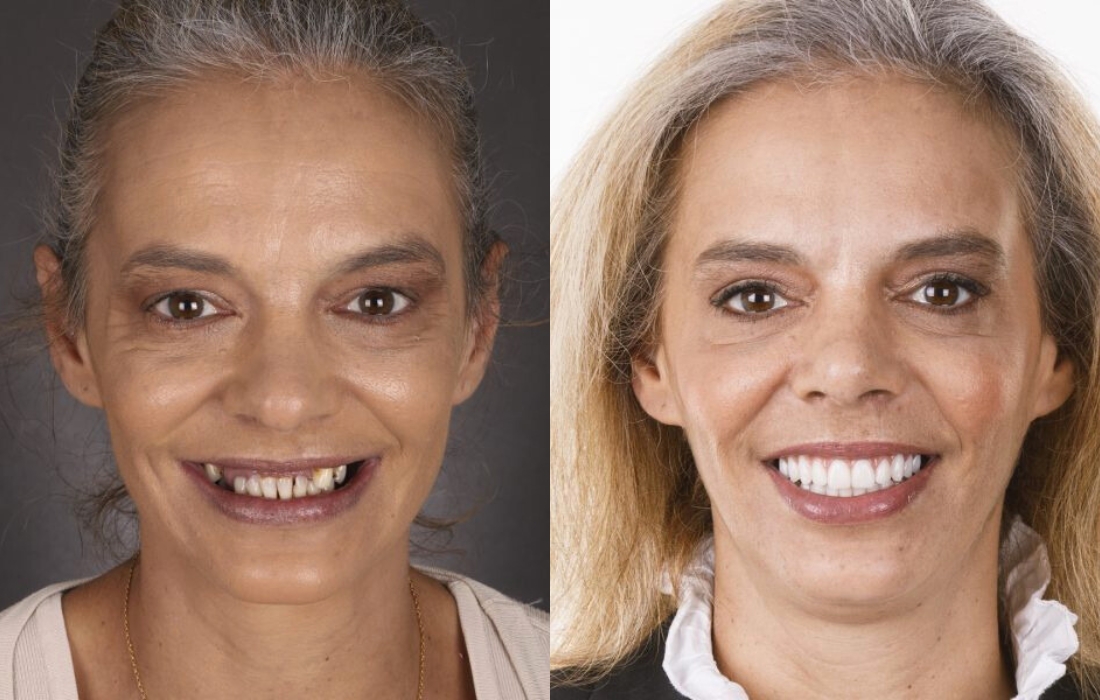 Mudanças de Visual - Casa Feliz - Clínica FMR