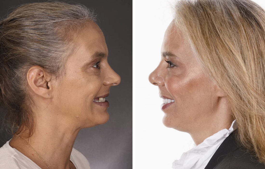 Mudanças de Visual - Casa Feliz - Clínica FMR