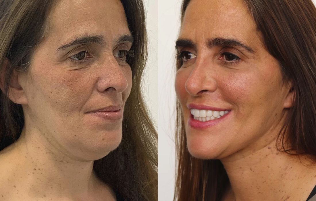 Mudanças de Visual - Casa Feliz - Clínica FMR