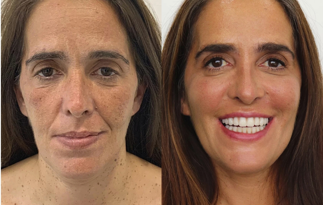 Mudanças de Visual - Casa Feliz - Clínica FMR