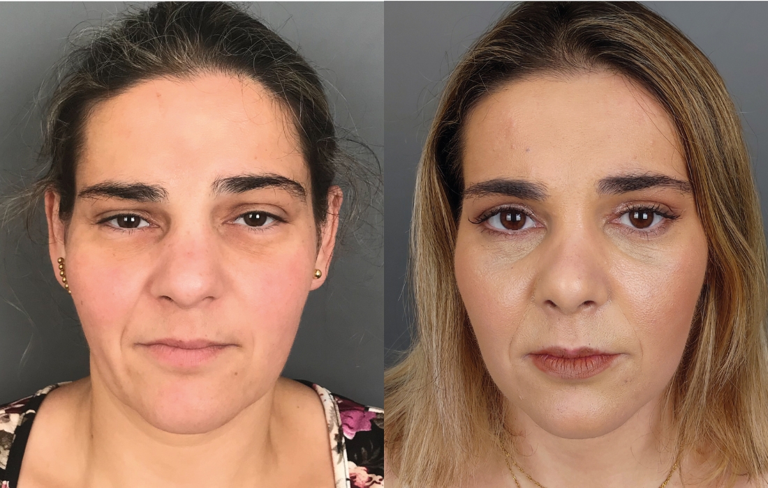 Mudanças de Visual - Casa Feliz - Clínica FMR
