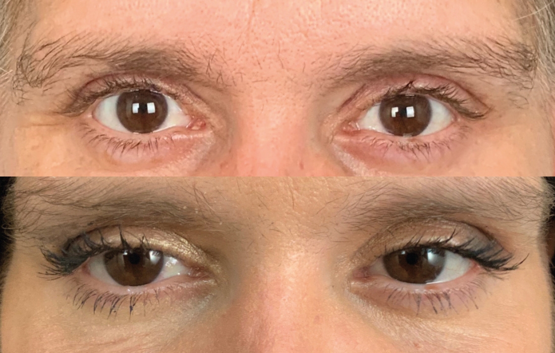 Mudanças de Visual - Casa Feliz - Clínica FMR