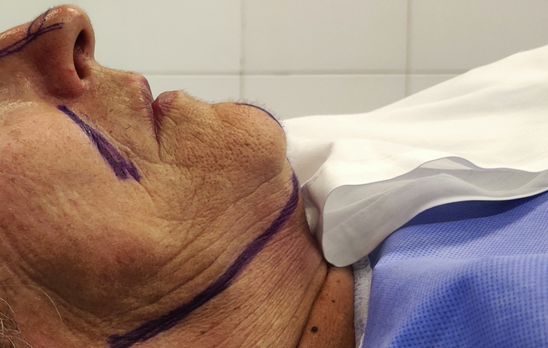 Tratamentos Masculinos Faciais - Clínica FMR