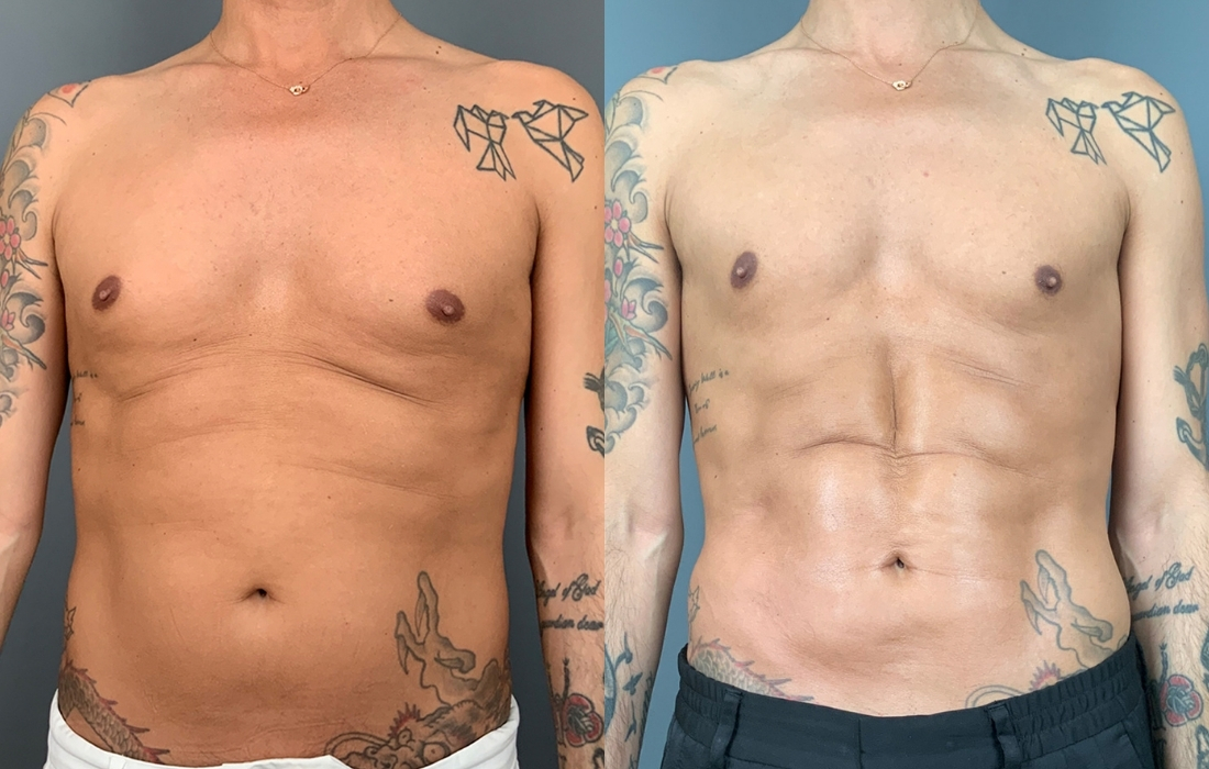 Tratamentos Masculinos Corporais - Clínica FMR