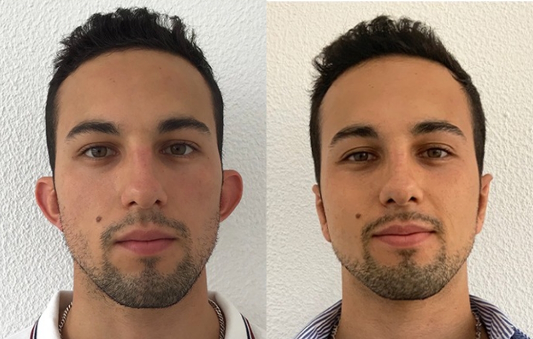 Tratamentos Masculinos Faciais - Clínica FMR