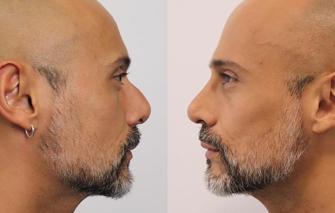 Tratamentos Masculinos Faciais - Clínica FMR