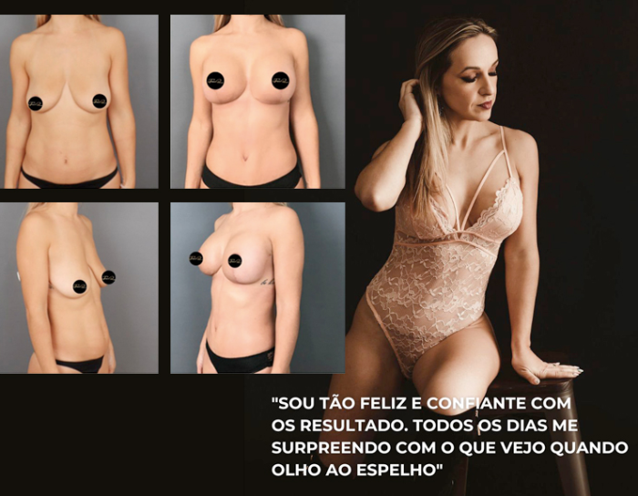My Bodyback - Cirurgias Combinadas - Clínica FMR